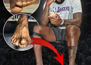 The Reality of LeBron James Feet After Decades in the NBA